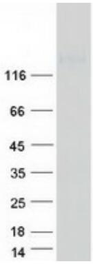 Coomassie blue staining of purified ITGAM protein.